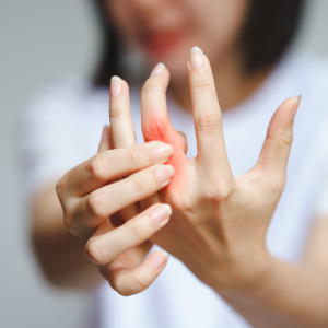 Arthritis